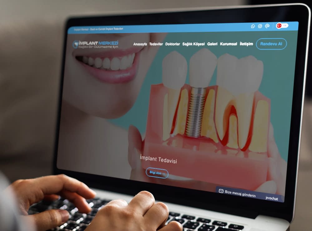 Implant Merkezi 2